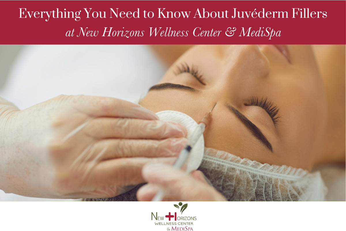 Everything You Need to Know About Juvéderm Fillers at New Horizons Wellness Center & MediSpa