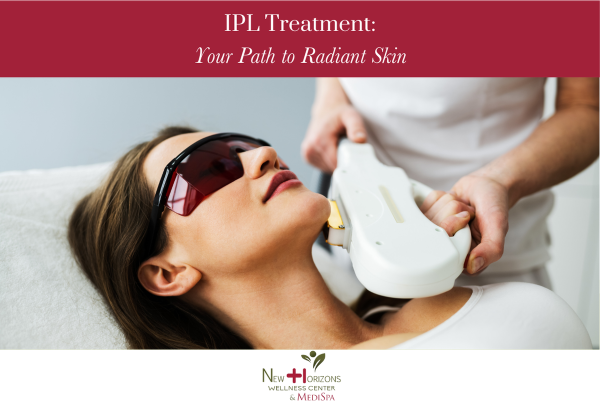 IPL Treatment Your Path to Radiant Skin